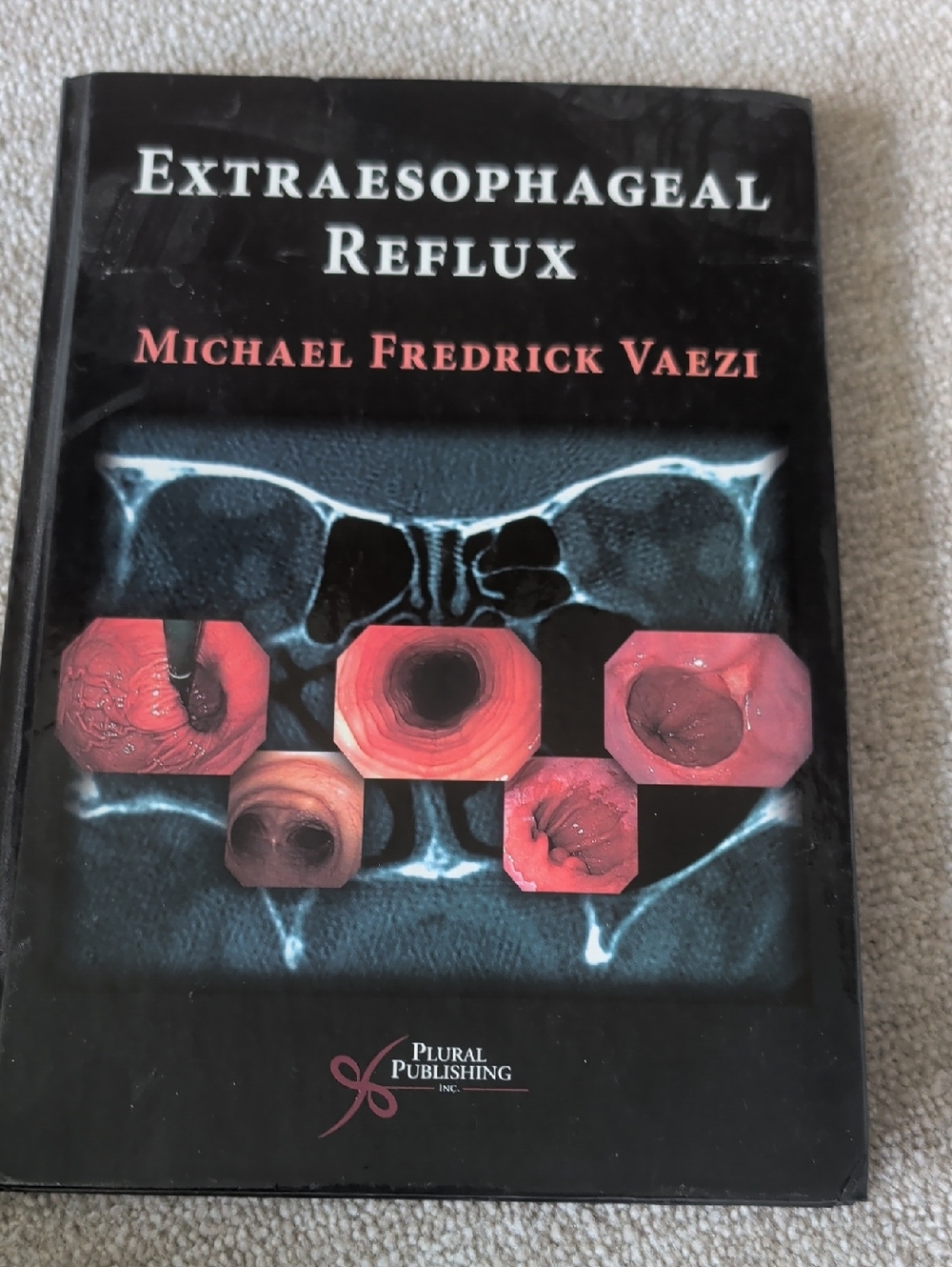 Extraesophageal Reflux by Michael Fredrick Vaezi - Black Medical Hardcover
